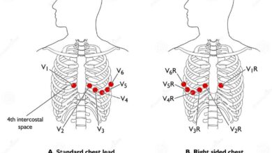 leads on ecg